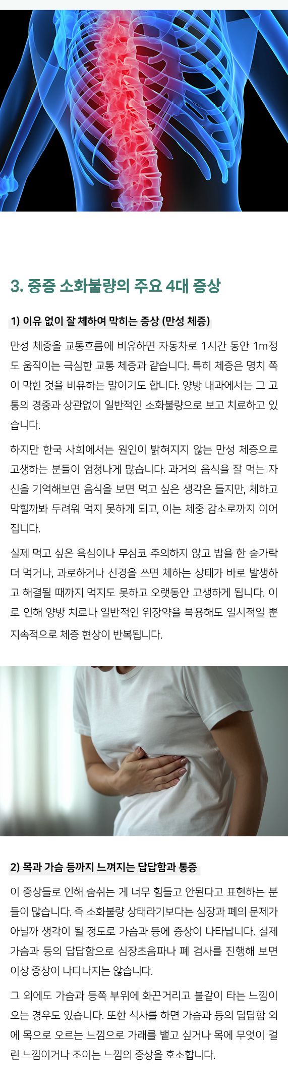 중증소화불량