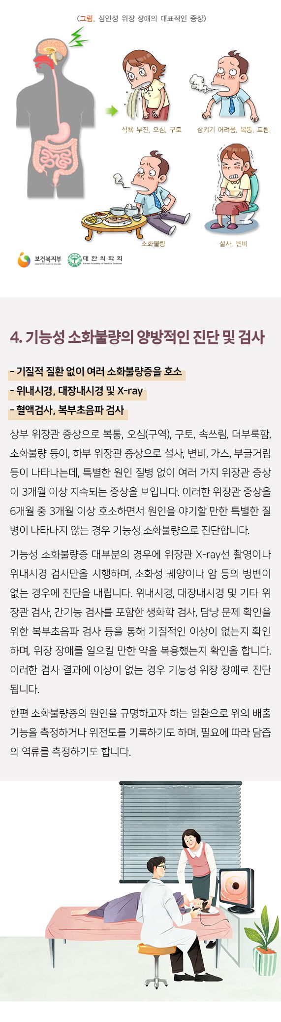 기능성소화불량