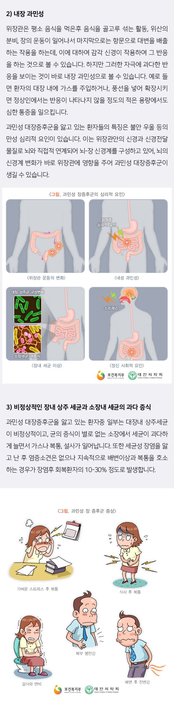 과민성대장증후군