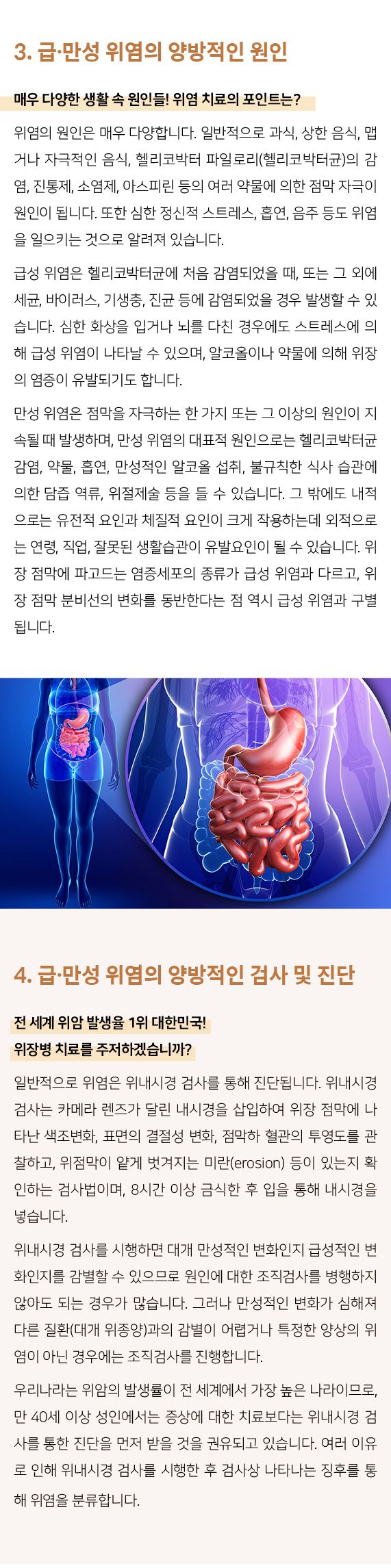 급만성위염