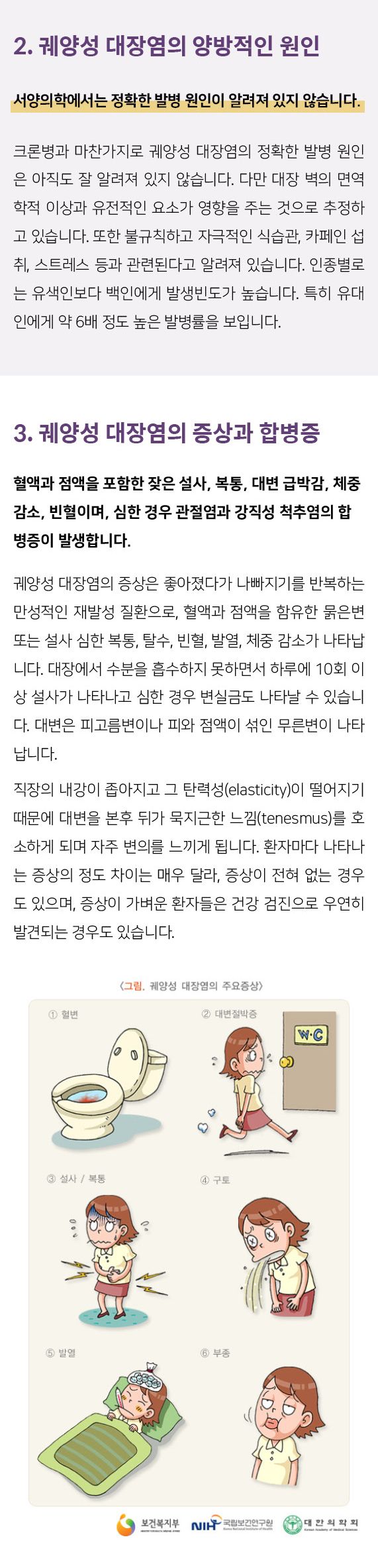 궤양성대장염