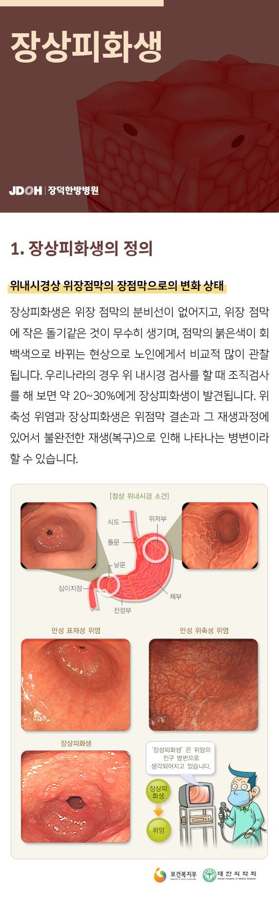 장상피화생