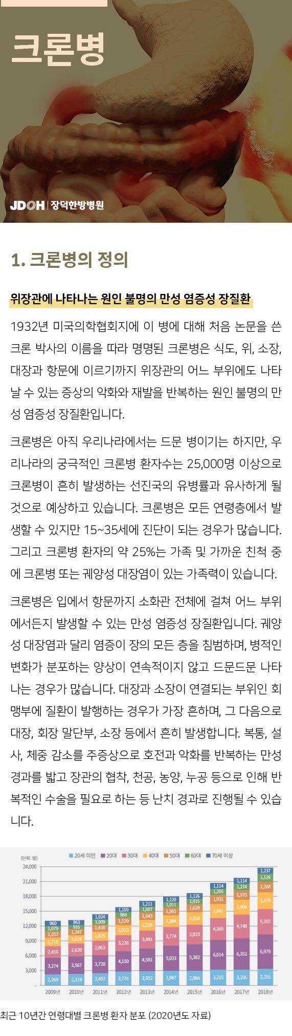 크론병