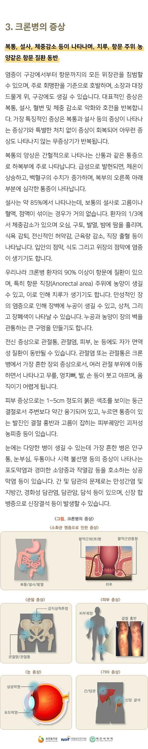 크론병